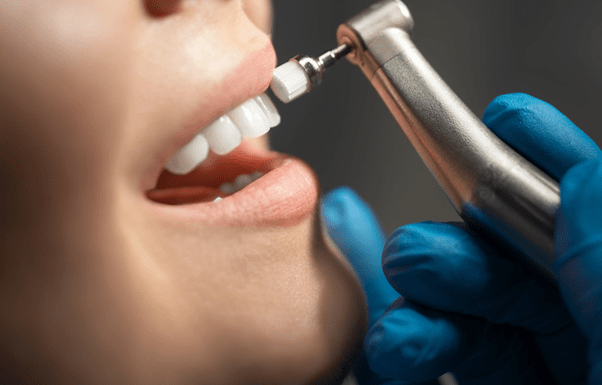 Top-5-Signs-Youre-Overdue-for-a-Dental-Cleaning